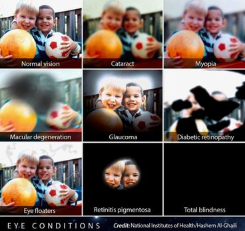 9 example images showing types of vision loss diagnosis symptoms