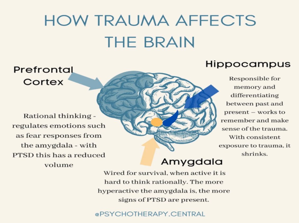 Infographic of how trauma affects the brain