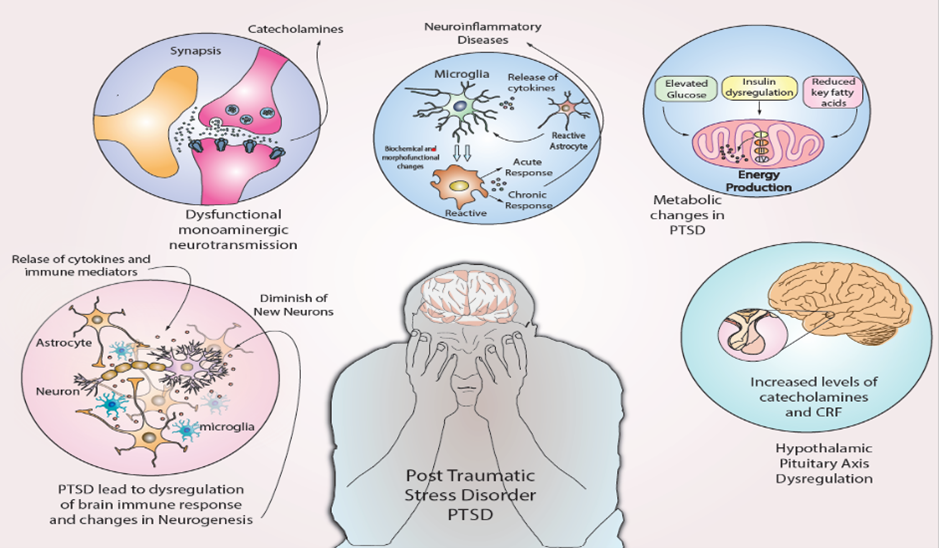 Educational infographic about Post-Traumatic Stress Disorder (PTSD)