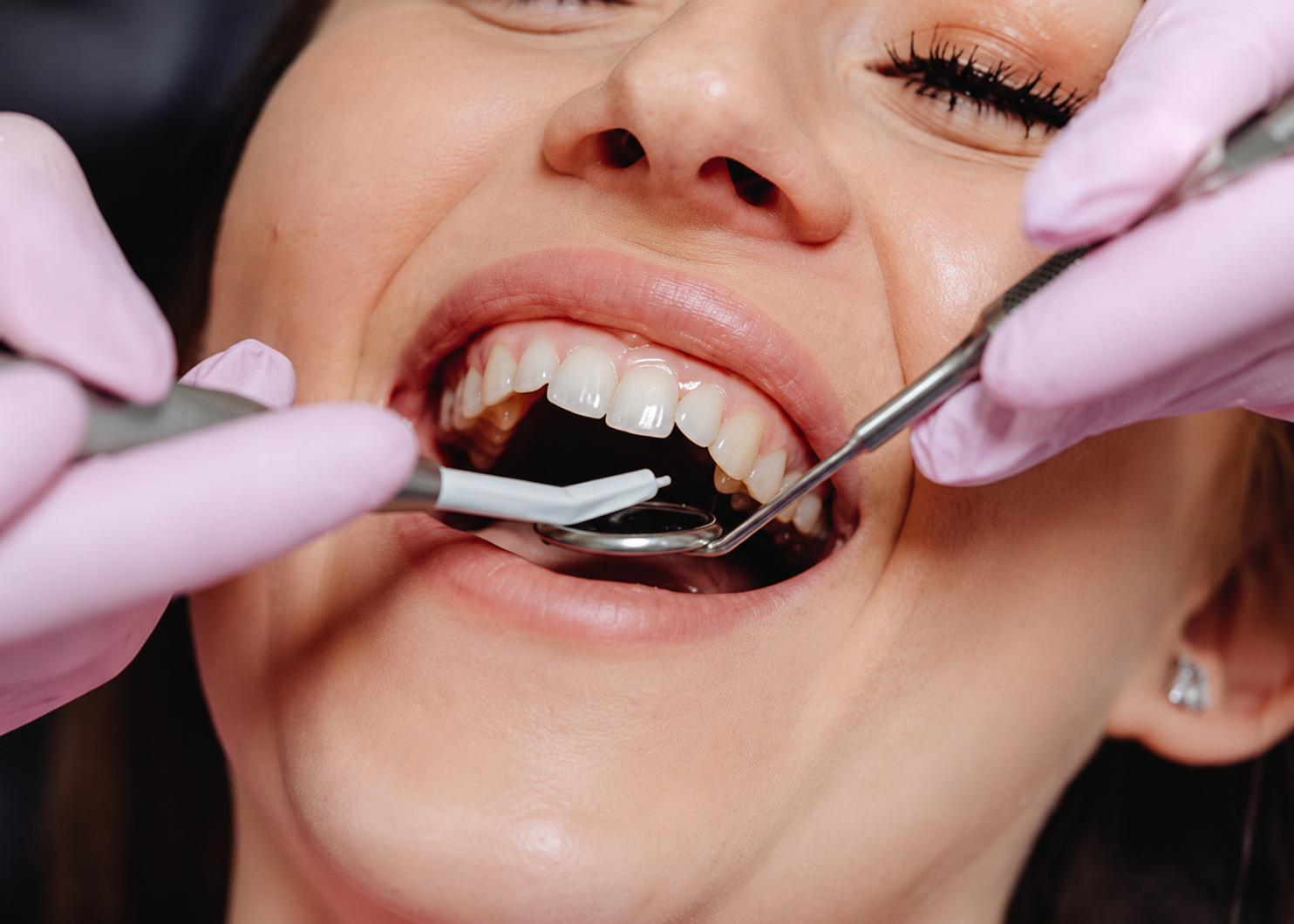 Dental tools examining a smiling patient’s teeth during a dental checkup