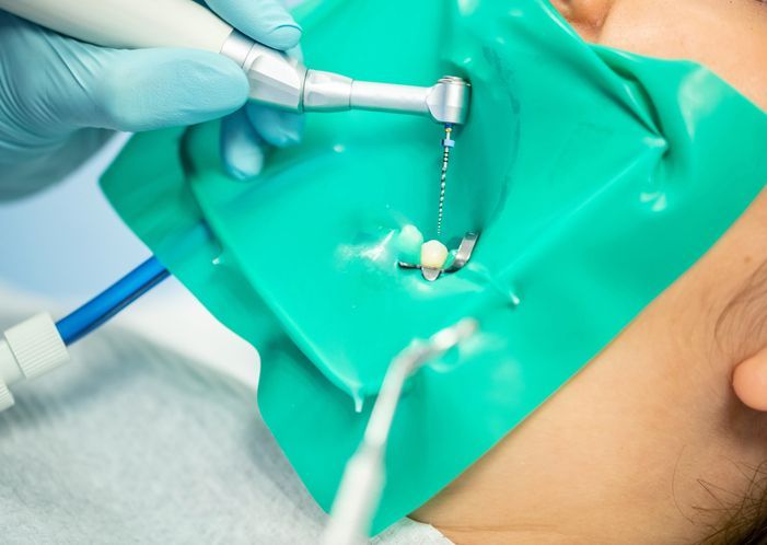 Dental drill treating a tooth under a green rubber dam, with gloved hands in close-up
