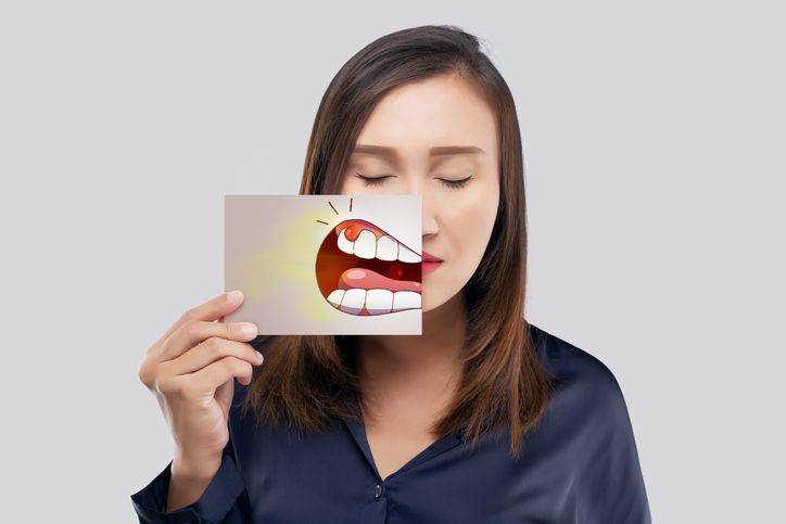 Split image of a smiling mouth, showing yellow teeth on one side and bright white teeth on the other.