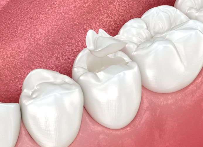 Close-up of healthy white teeth and pink gums in a mouth illustration