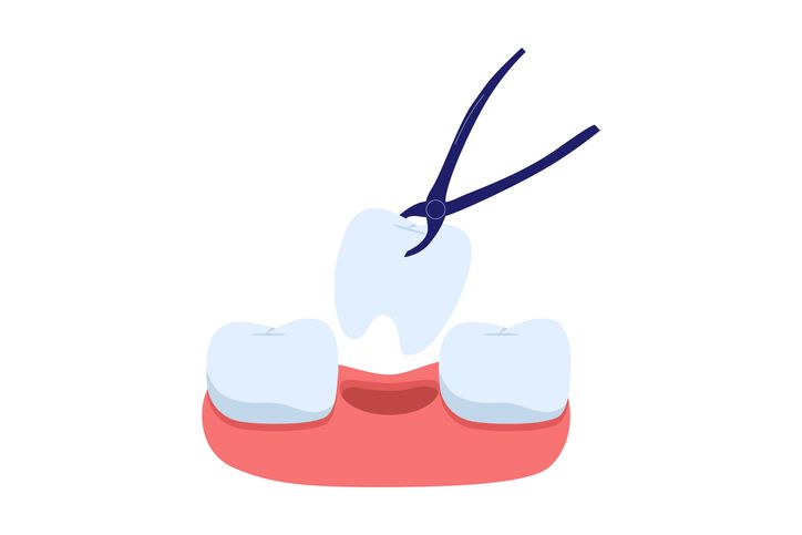 Three cartoon teeth on red gum, with a dark blue arrow pointing to the center tooth