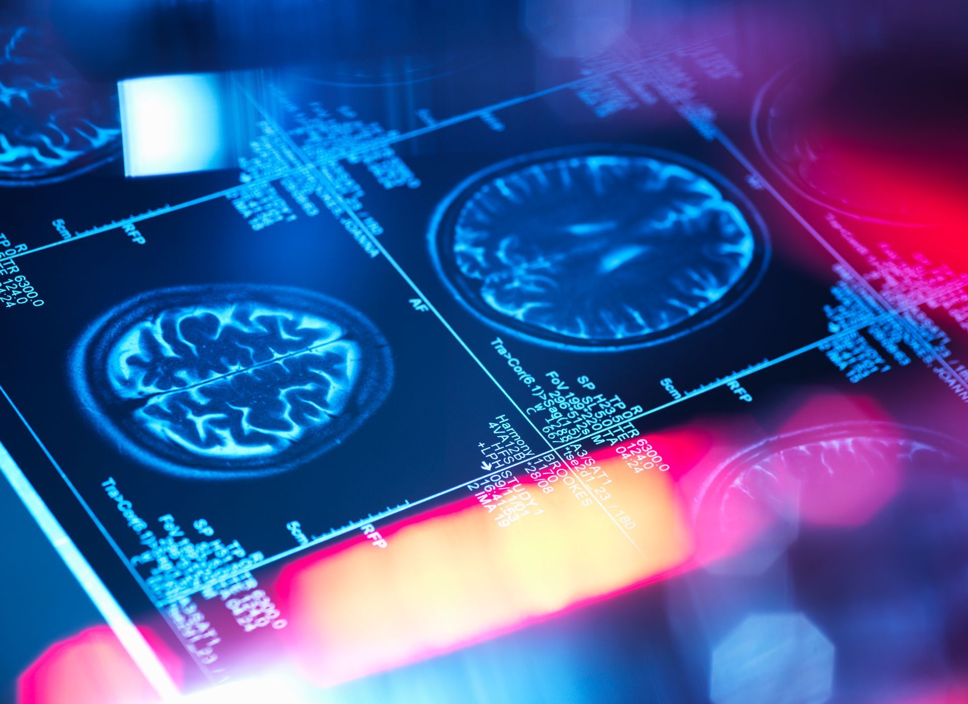 Neon-blue brain scans on a futuristic medical display with pink and blue light accents