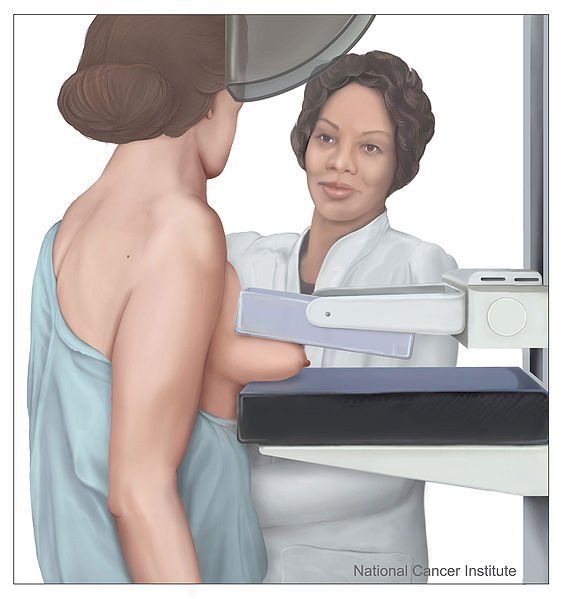 Breast Cancer Screening