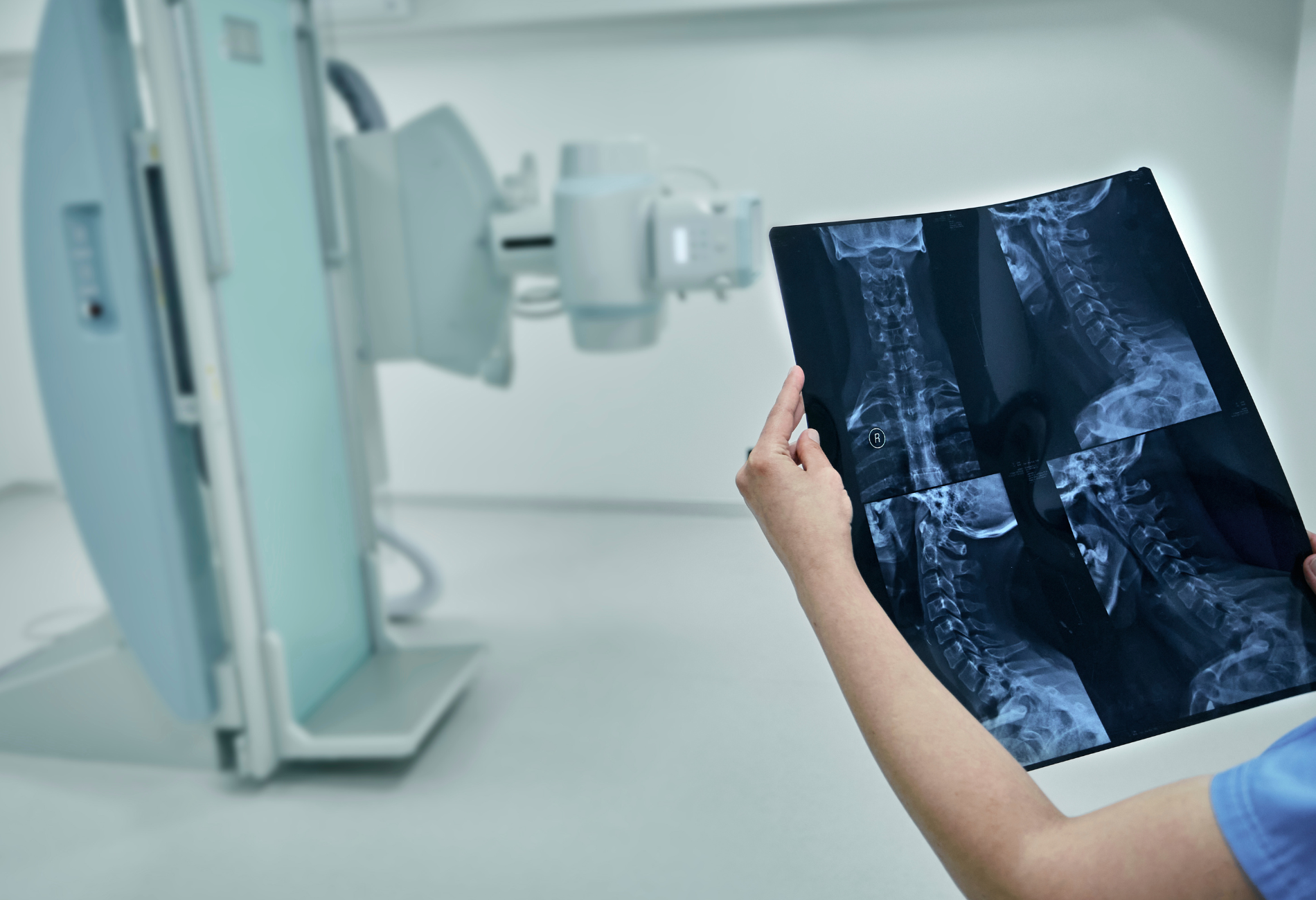 xray of spine