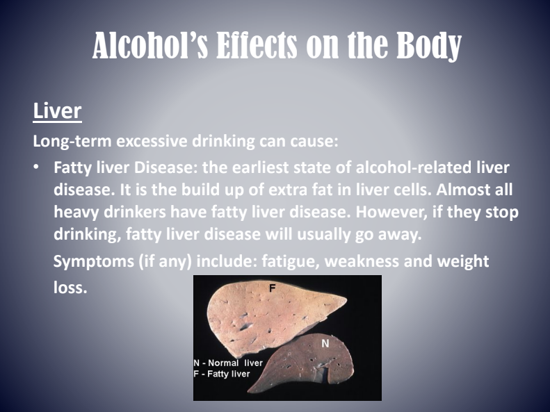 Alcohol’s effects on the body infographic about liver disease and symptoms with liver image.