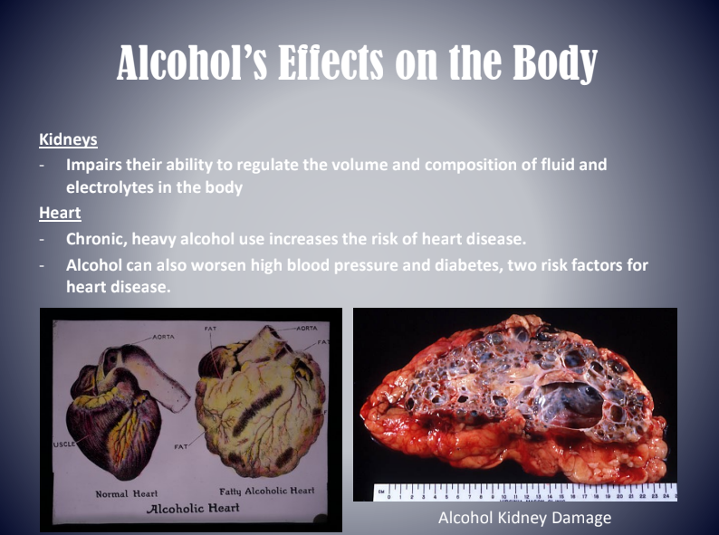 Infographic on alcohol's effects on the body, showing kidney and heart damage photos.