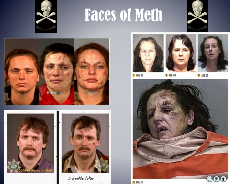 Collage titled “Faces of Meth” showing mugshots and a severely disfigured person from meth use