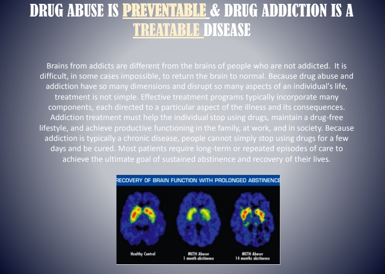 Anti-drug poster with bold headline and brain scan images on a blue background