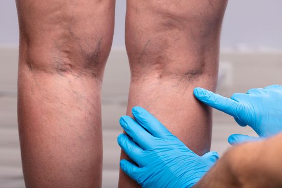 A person wearing blue gloves is examining another person 's leg