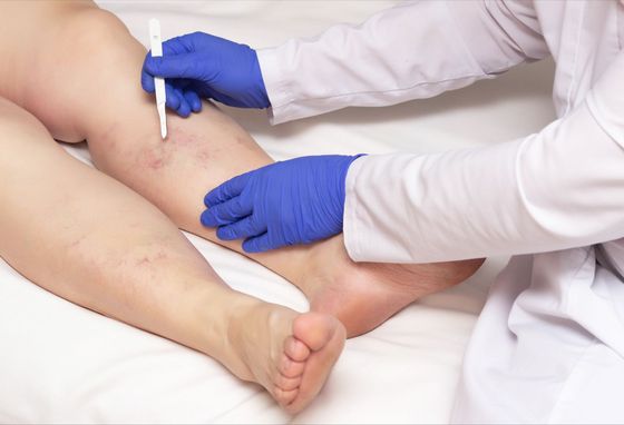 A doctor wearing blue gloves is examining a patient 's leg