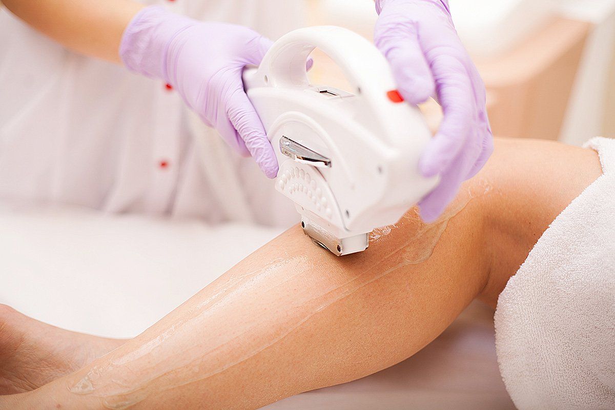 epilazione laser