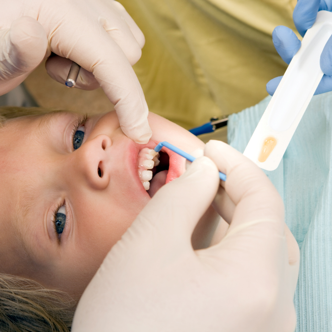 Young boy getting a fluoride treatment at the pediatric dentist
