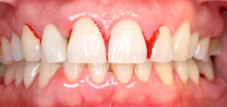 CLÍNICA DE PERIODONCIA 