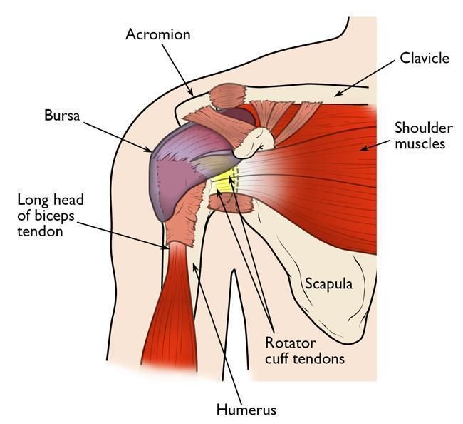 Labeled diagram of the shoulder showing acromion, clavicle, scapula, humerus, bursa, and rotator cuff tendons.