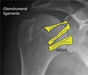 X-ray of shoulder highlighting glenohumeral ligaments and AIGHL in yellow.