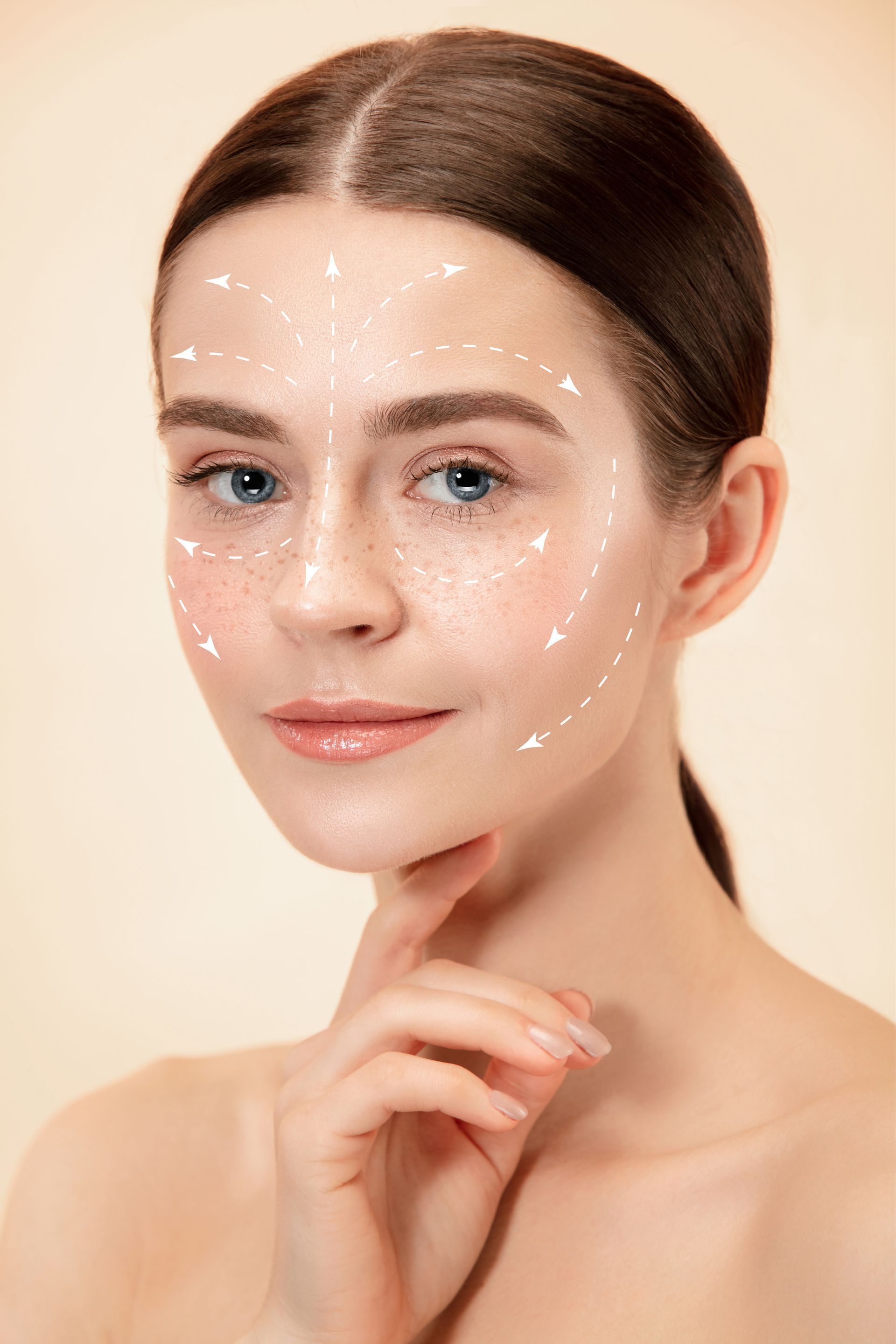 Woman with dotted facial skincare markings, resting chin on hand against a beige background