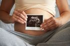 A pregnant person holds an ultrasound scan in front of their belly while sitting.