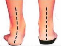 ORTOPEDIA Y ZAPATERÍA LUIS RODRÍGUEZ - Atención en ortopedia