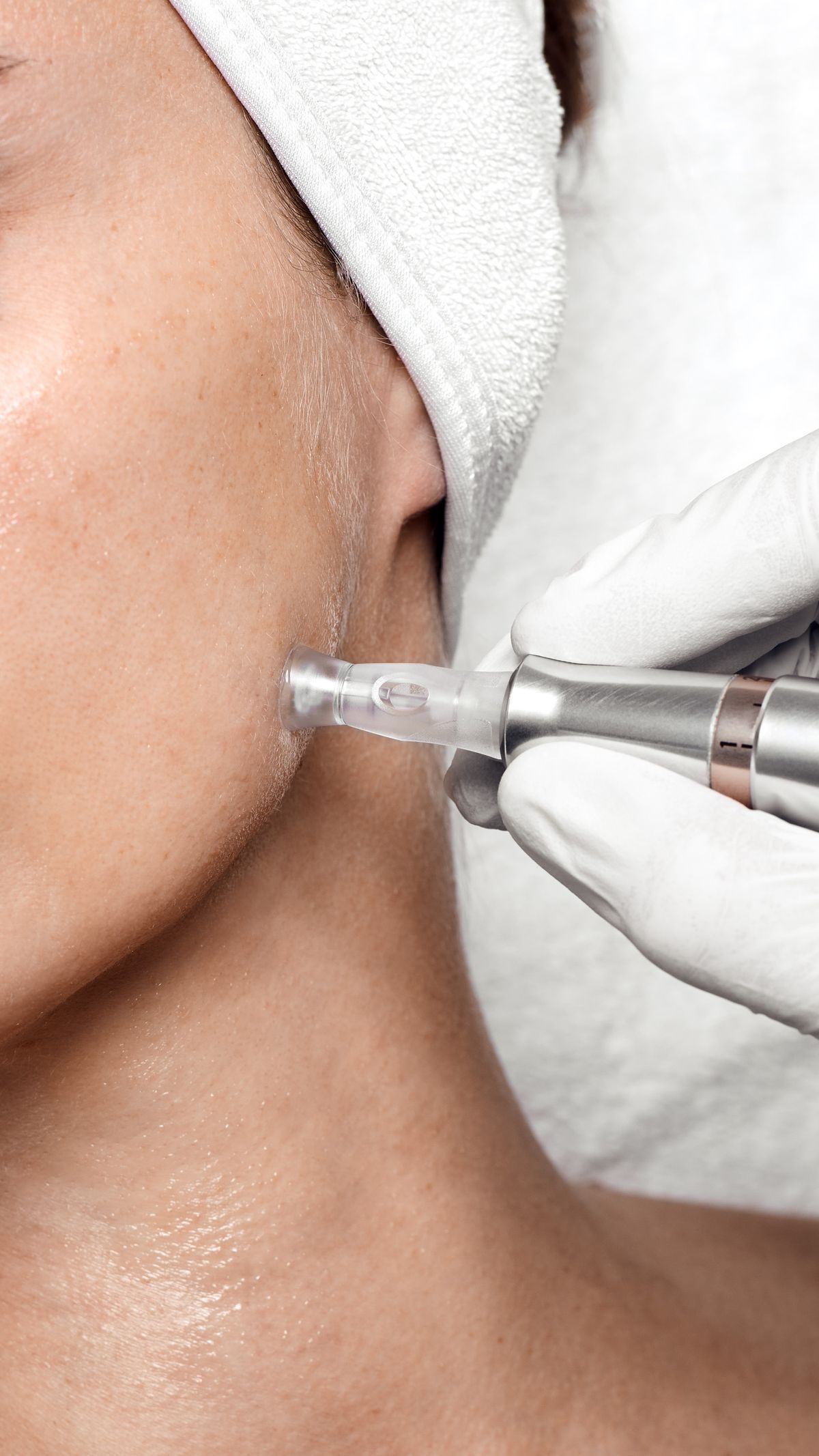 Curso Bioestimulação - EXCLUSIVO Ex-Alunas Definitá
