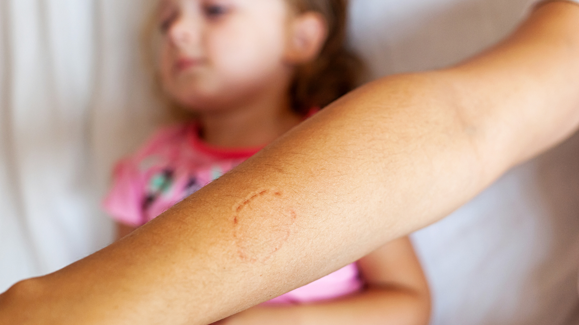 Handling Biting in Preschool: Practical Tips for Parents