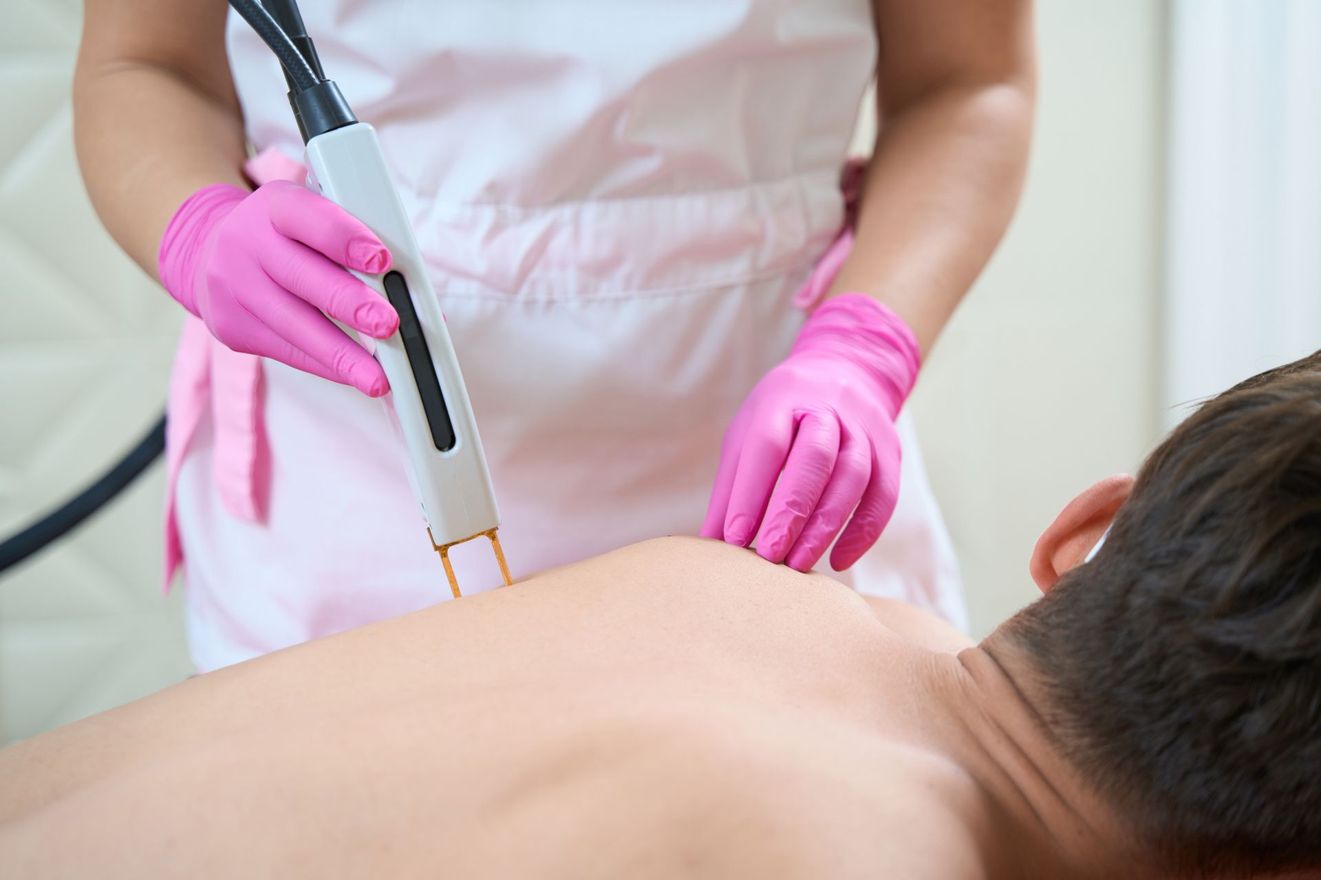 Laser Hair Removal