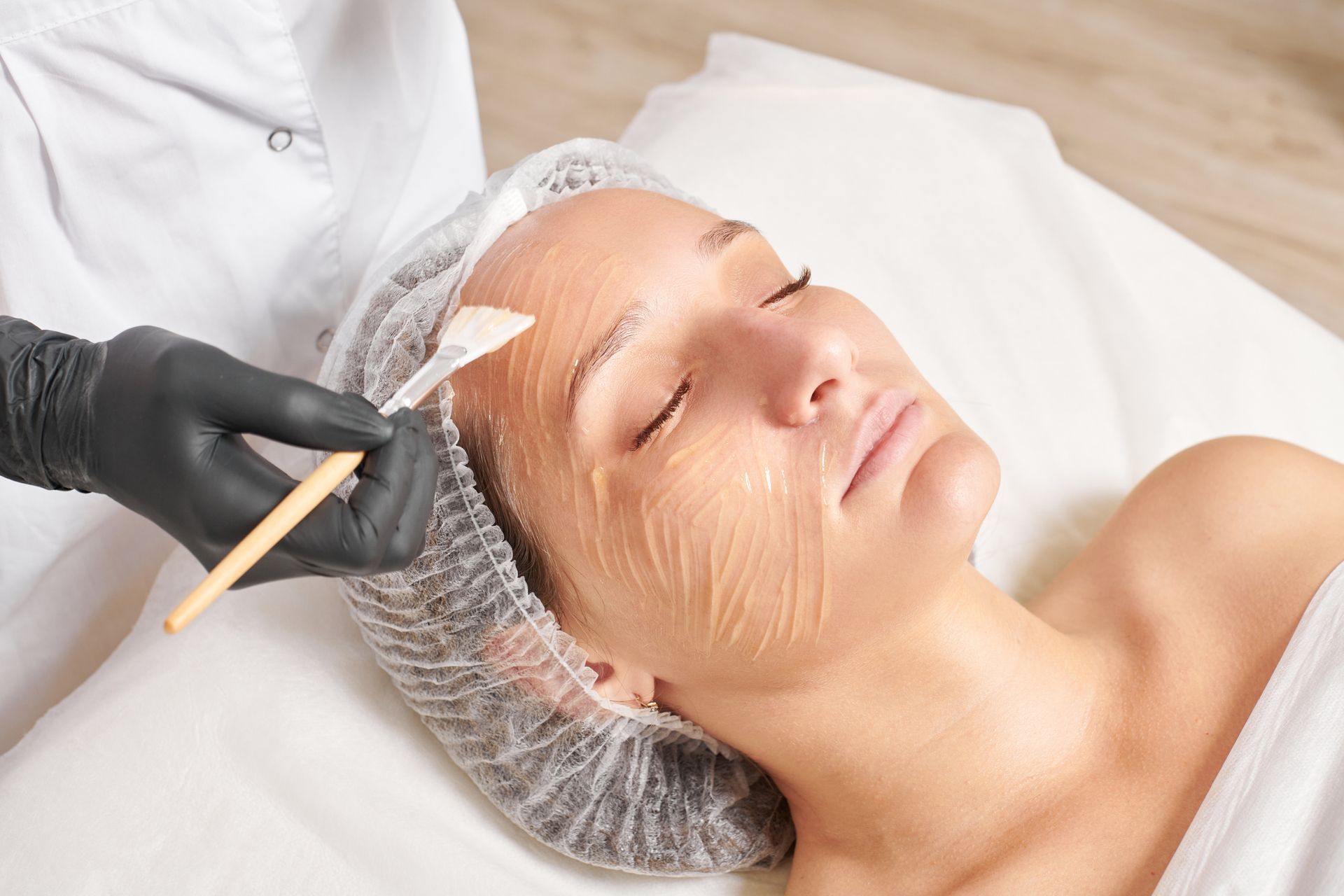 Chemical Peels