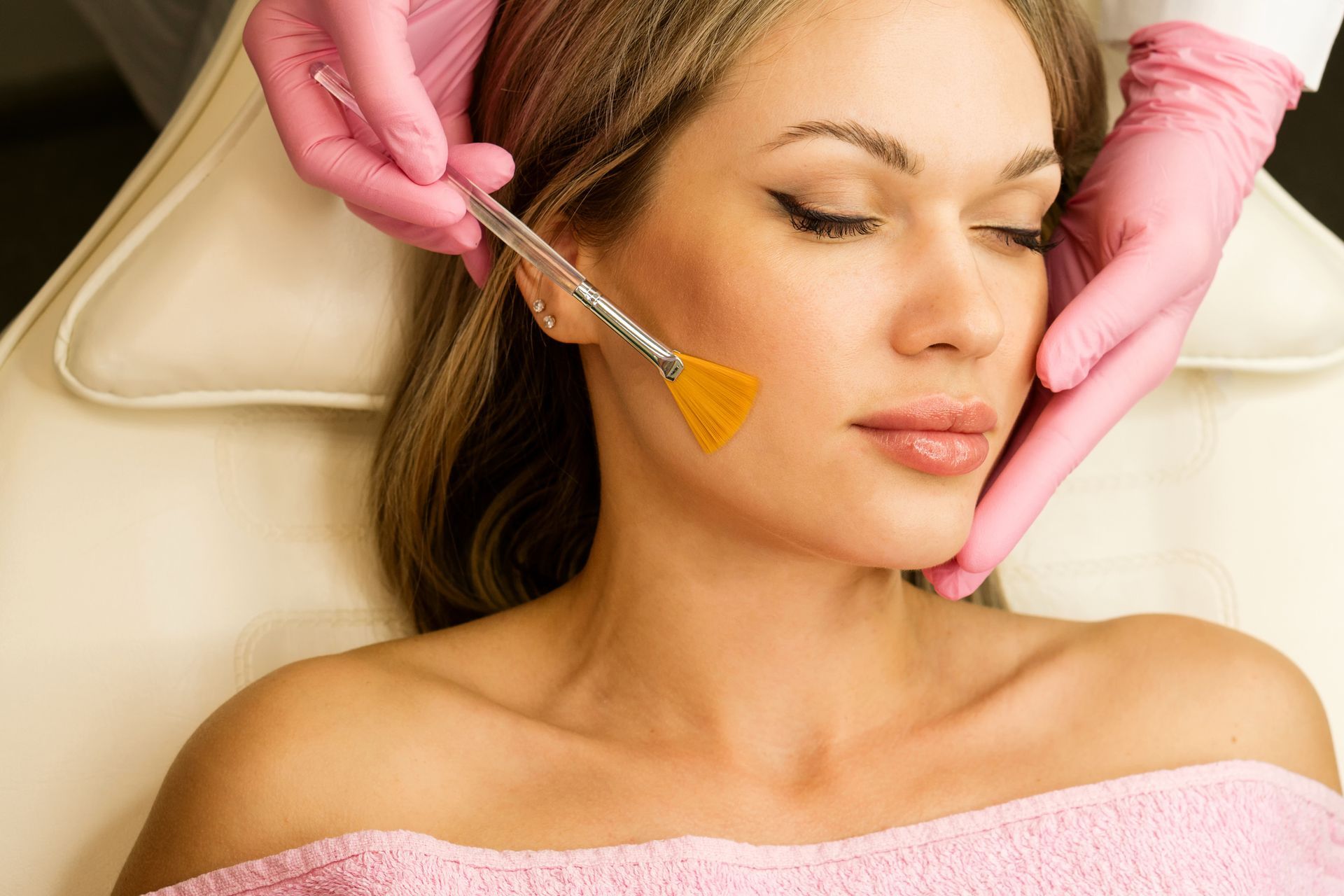 Chemical Peels