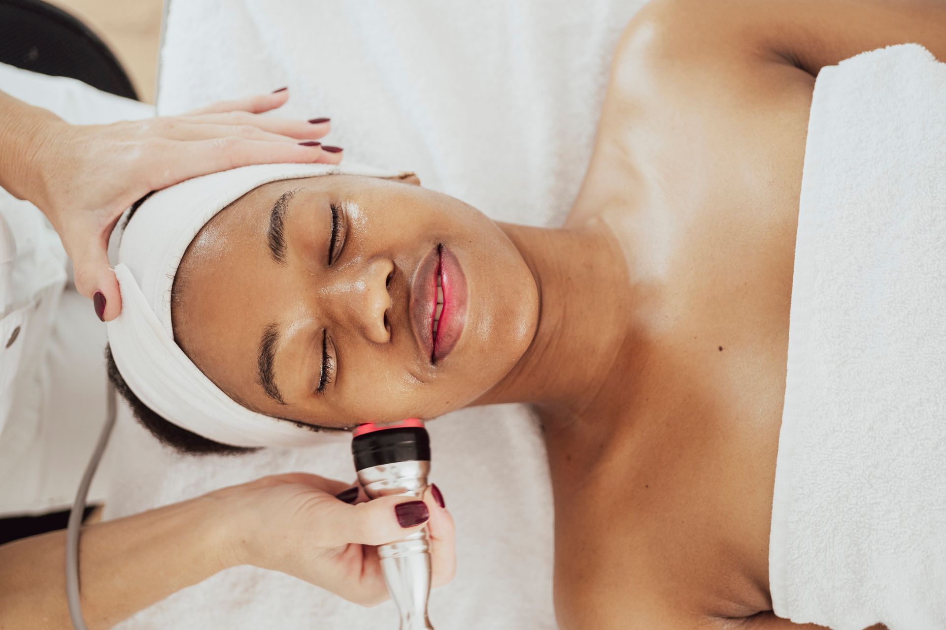 RF Microneedling