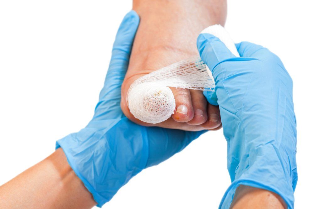 Putting Bandage on the Toe — Fungal Nail Treatments in Urunga, NSW