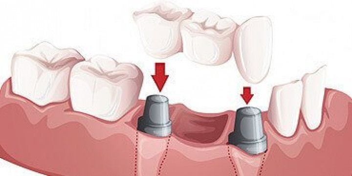 Dental Diagram