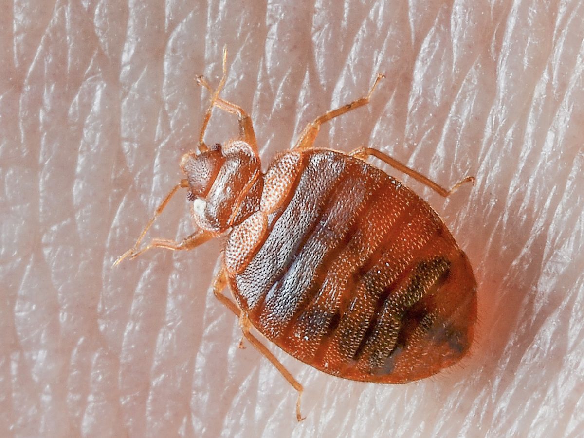picture of bed bug on skin