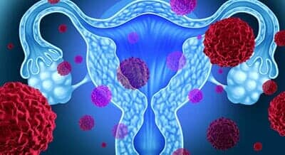 DRA. TERESA SANDOVAL SANDOVAL - Verrugas genitales o cáncer