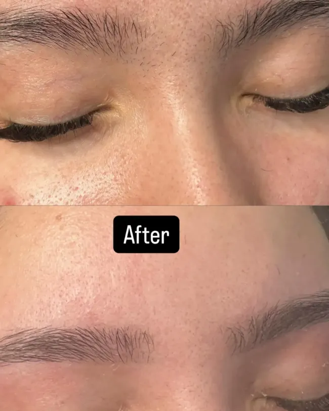 Close-up before-and-after of eyebrow shape and fullness, with an "After" label on the lower image