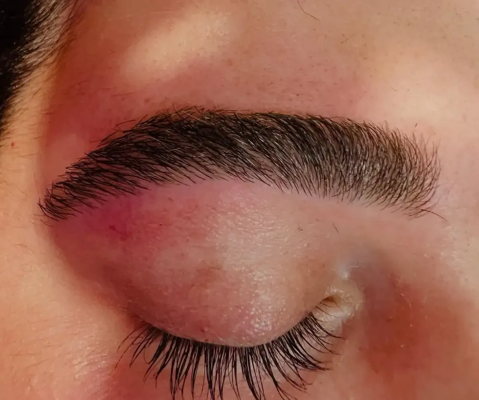 Close-up of a closed eye with a dark eyebrow, pink eyeshadow, and visible cheek redness
