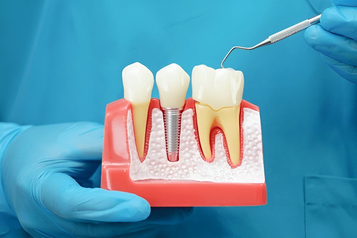 teeth whitening brooklyn