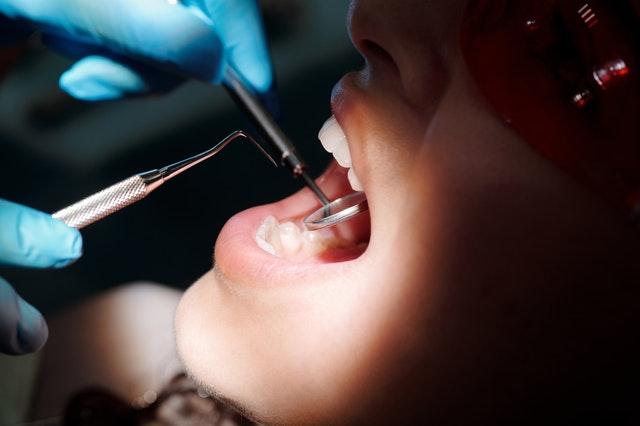 teeth whitening brooklyn
