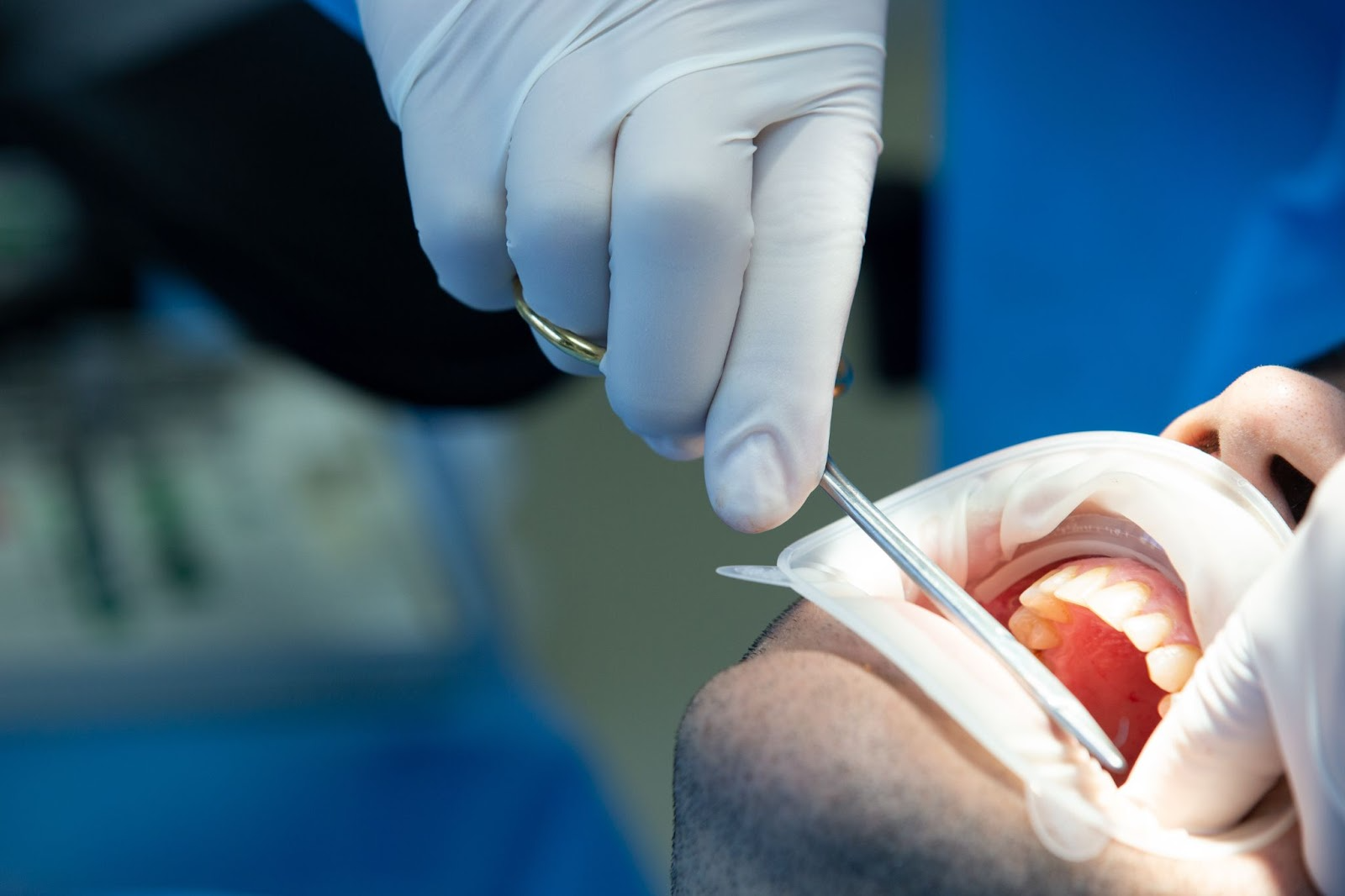 teeth whitening brooklyn