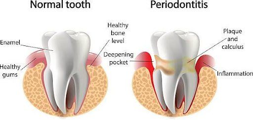 advanced dental care brooklyn