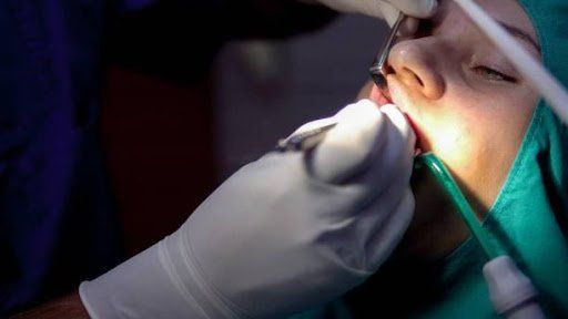 teeth whitening brooklyn