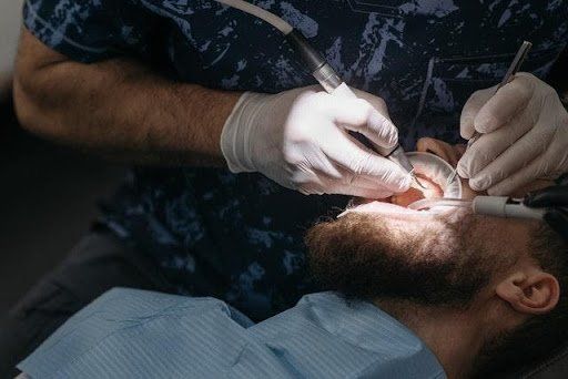dental implants brooklyn