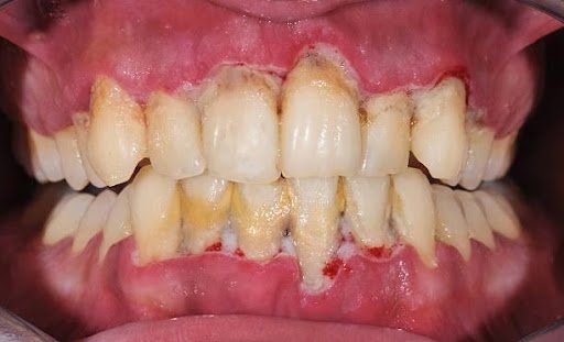 advanced dental care brooklyn