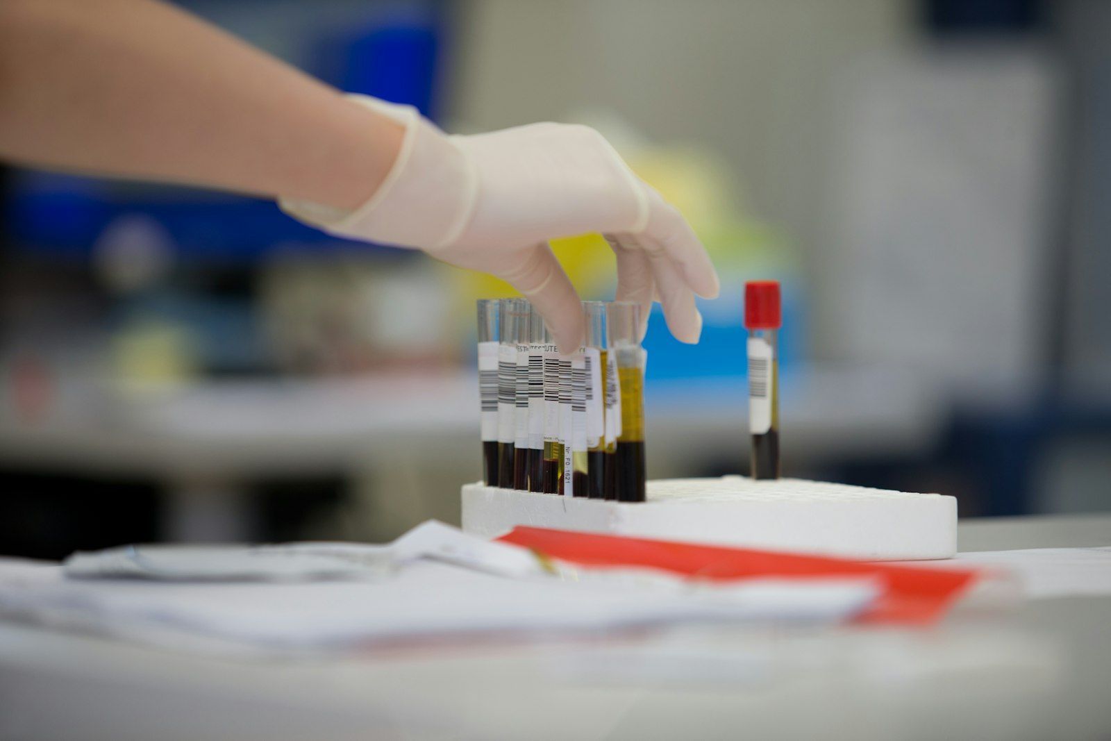 Gloved hand holding a blood sample tube