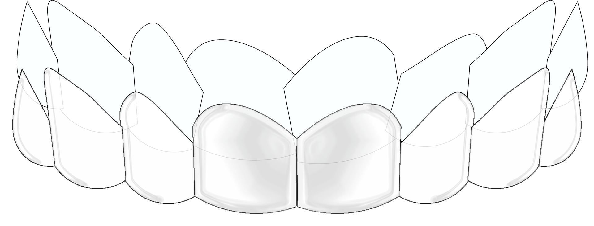 suresmile