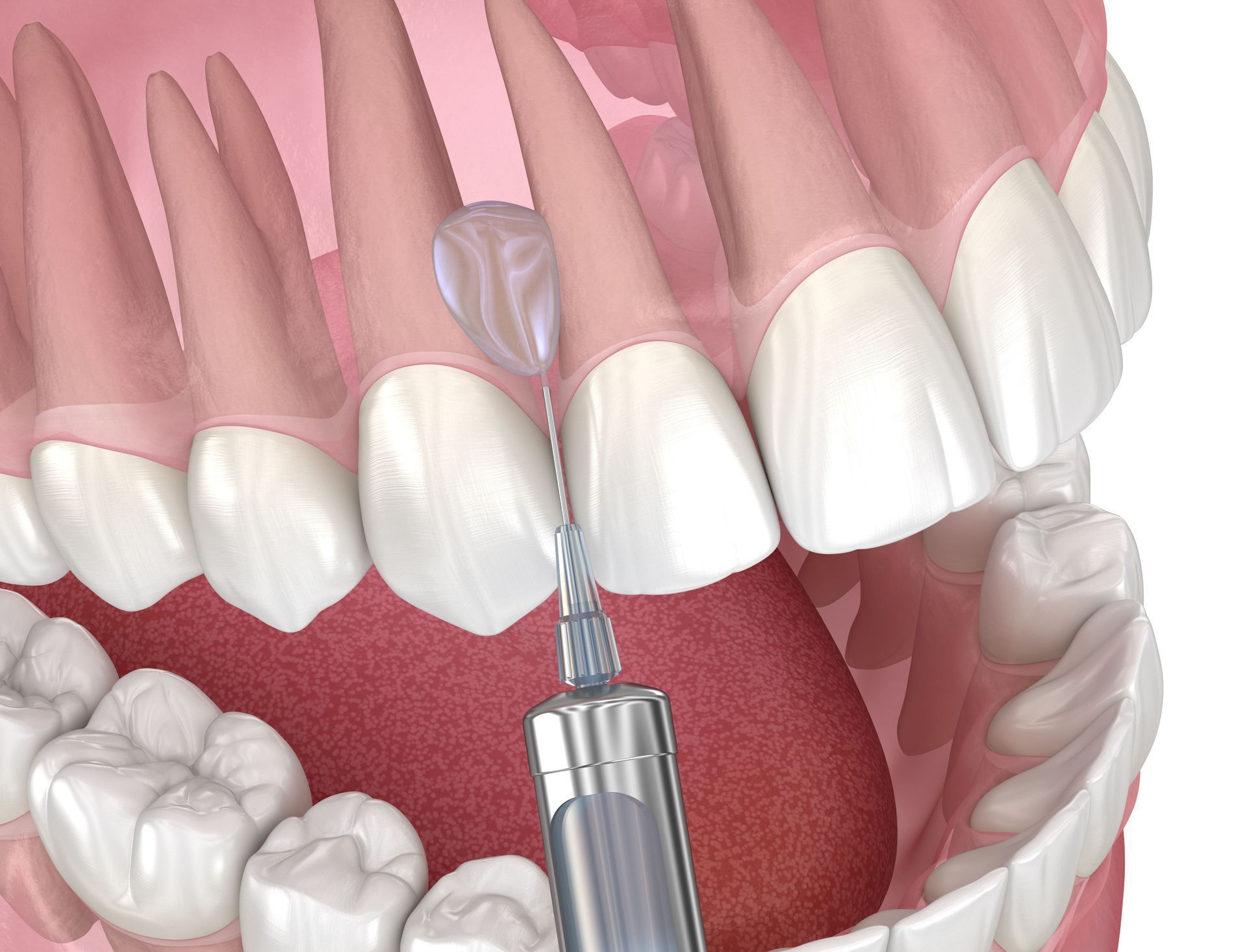 oral surgery