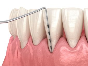 general dentistry