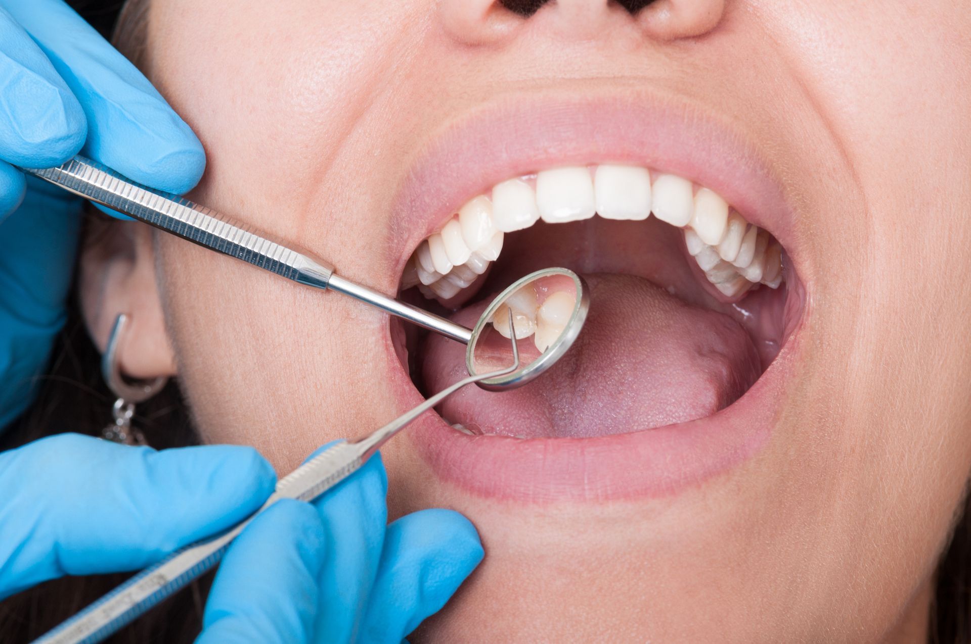 Close-up of a patient with her mouth open, showing her teeth at a dental clinic.
