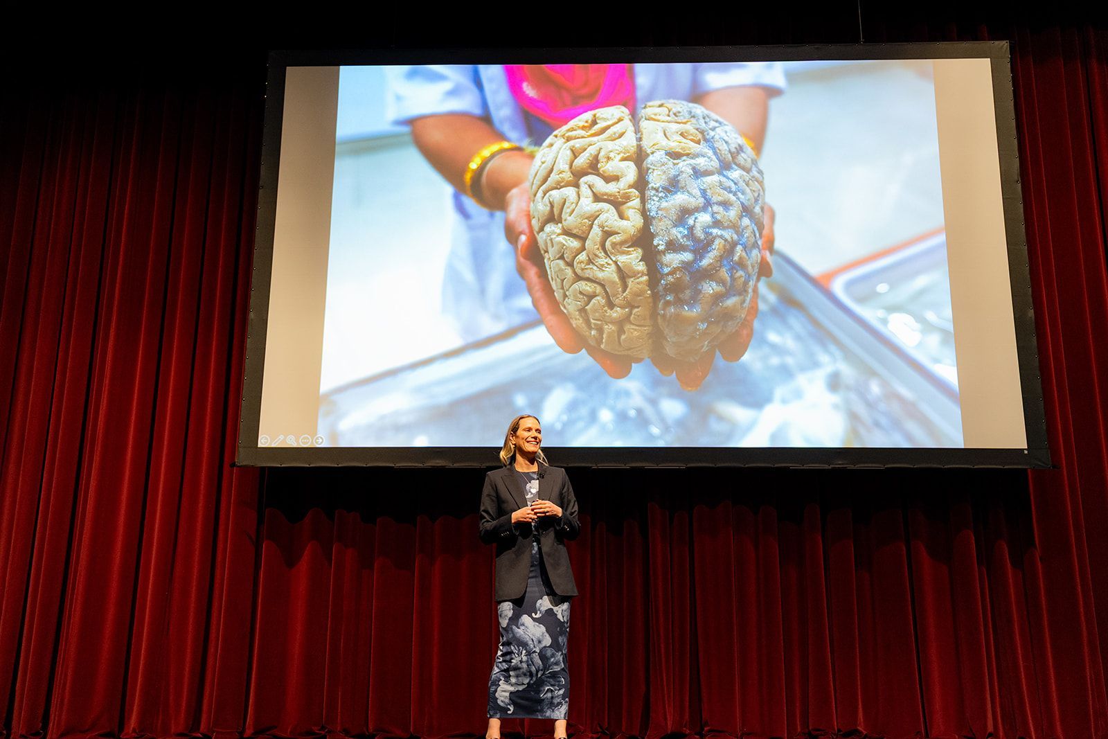 Speaker on stage presenting a brain image on a large screen